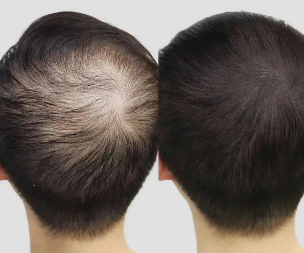 Lustrao Complete Regrowth System-2